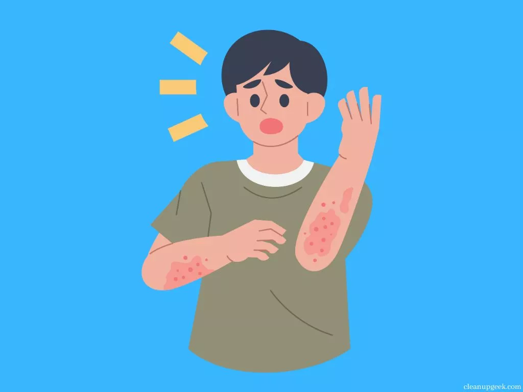 Skin Irritation